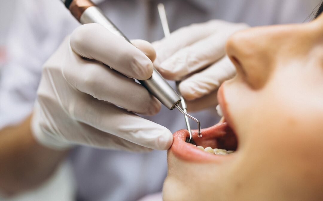 Call for a Consultation for Dental Implants at Beyond
